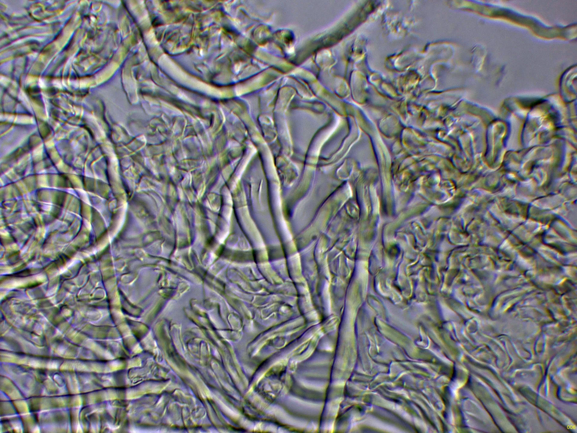 Microscopía de Rigidoporus vinctus - 10 - Hifas KOH-006